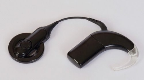 4. Koxlear implantant