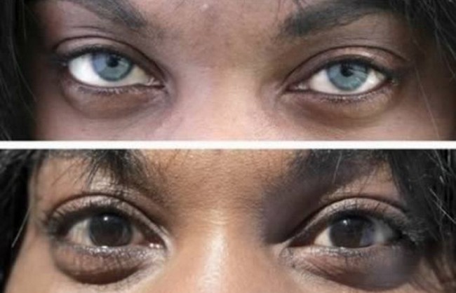 Ko’zni o’zgartirish