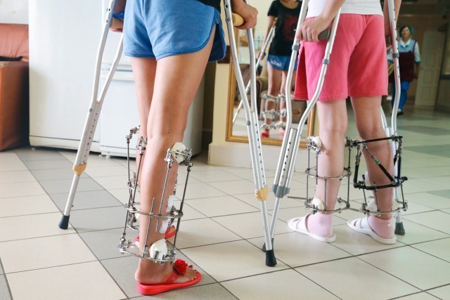 Oyoqlarni uzaytirish