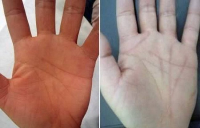 Kaftdagi chiziqlarni o‘zgartirish