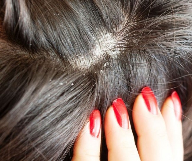 10. Qazg’oqqa qarshi vosita