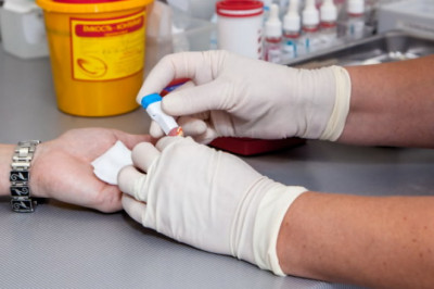 Nima uchun tahlillar vaqtida qon nomsiz barmoqdan olinadi?