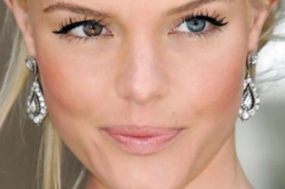 Insonning mukammali bo’lmaydi: Mashhur yulduzlarning siz bilmagan kichik nuqsonlari